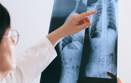Doctor pointing to two x-rays of someone's torso.